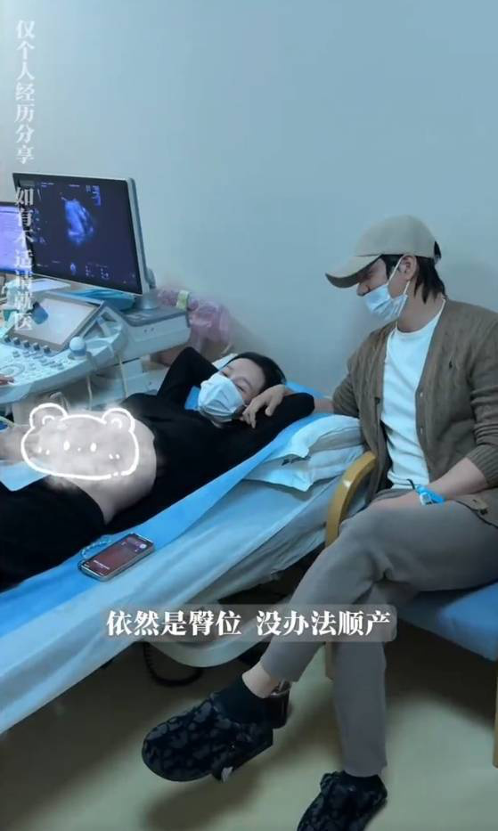 张檬坦言：35周胎儿臀位绕颈，剖腹产成必然 -1